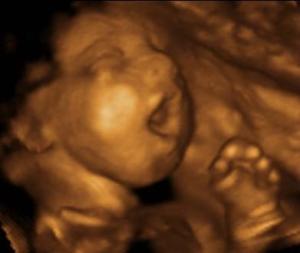 Imagen 3D de un bebé dentro del vientre materno. 