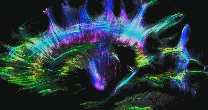 Tractography_animated_lateral_view